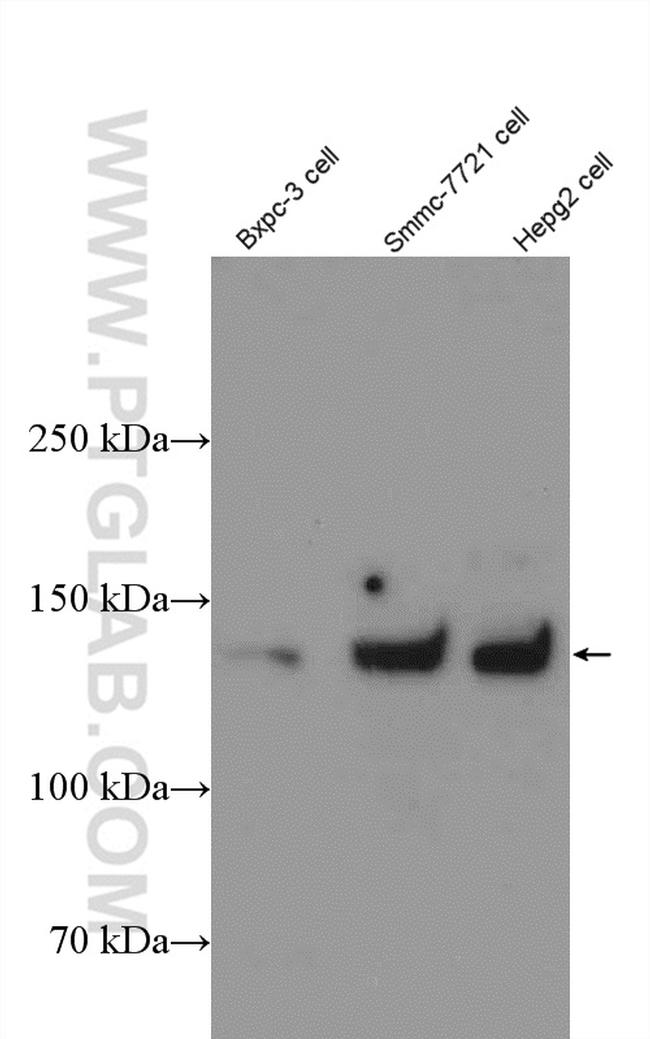 MGEA5 Antibody in Western Blot (WB)