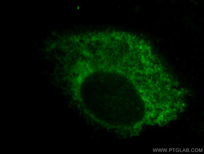 ERp72 Antibody in Immunocytochemistry (ICC/IF)