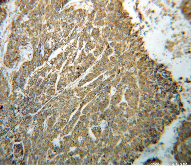 ERp72 Antibody in Immunohistochemistry (Paraffin) (IHC (P))