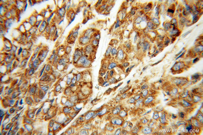 ERp72 Antibody in Immunohistochemistry (Paraffin) (IHC (P))