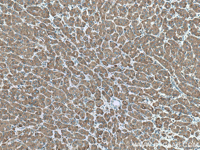 ERp72 Antibody in Immunohistochemistry (Paraffin) (IHC (P))