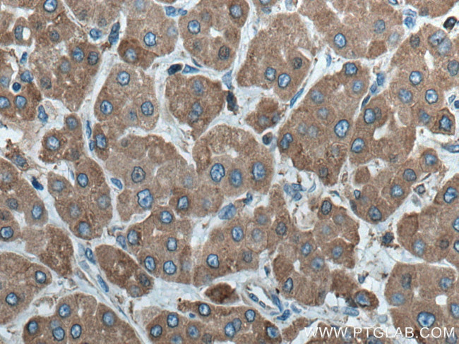 ERp72 Antibody in Immunohistochemistry (Paraffin) (IHC (P))