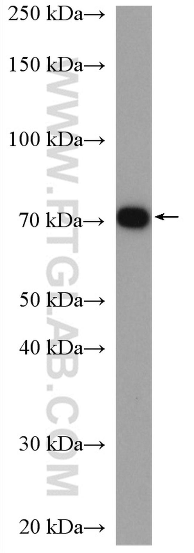 ERp72 Antibody in Western Blot (WB)