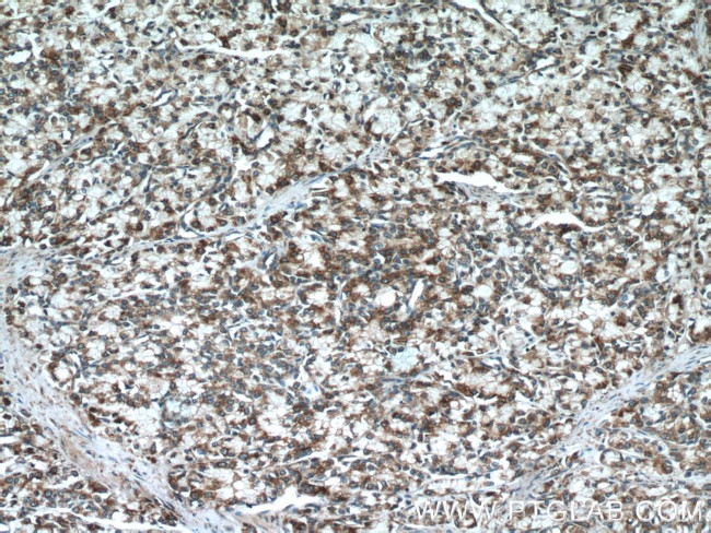 ERp72 Antibody in Immunohistochemistry (Paraffin) (IHC (P))