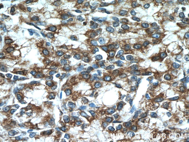 ERp72 Antibody in Immunohistochemistry (Paraffin) (IHC (P))