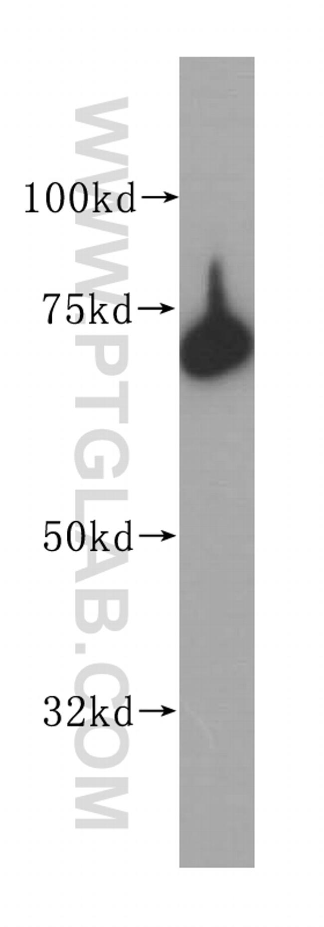 ERp72 Antibody in Western Blot (WB)