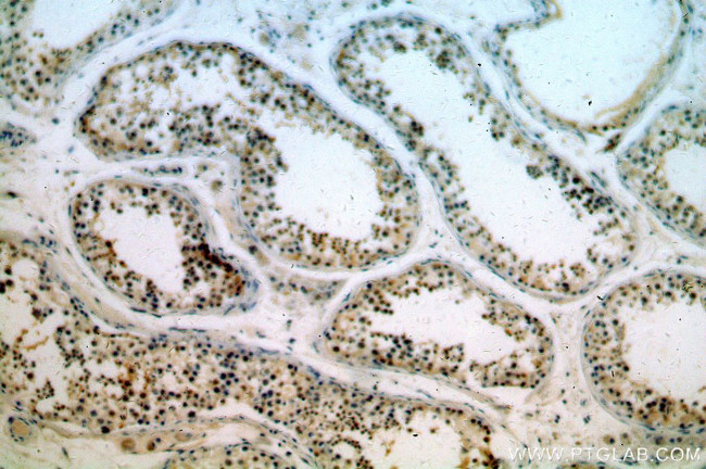 KLF6 Antibody in Immunohistochemistry (Paraffin) (IHC (P))