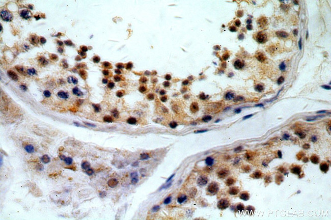 KLF6 Antibody in Immunohistochemistry (Paraffin) (IHC (P))