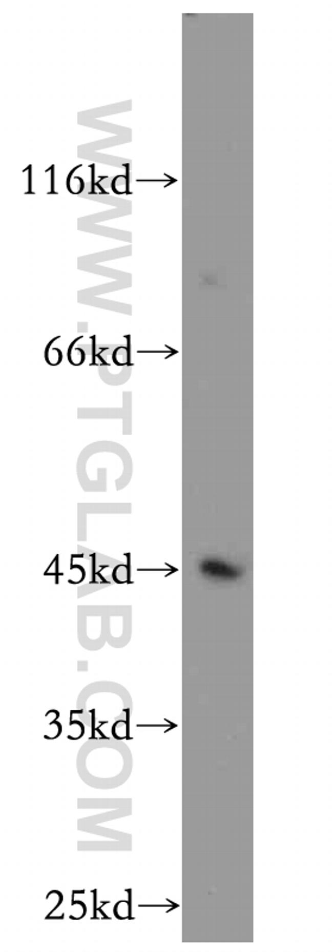 KLF6 Antibody in Western Blot (WB)