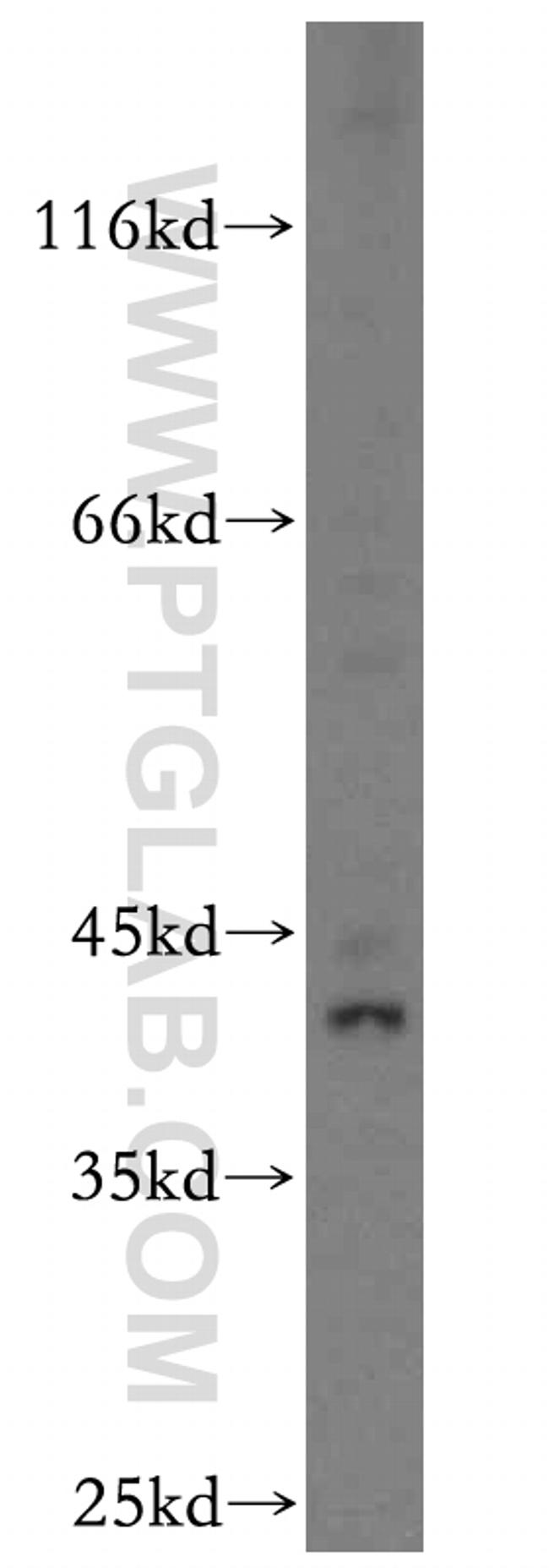 KLF6 Antibody in Western Blot (WB)