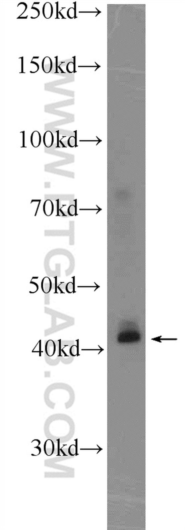 KLF6 Antibody in Western Blot (WB)