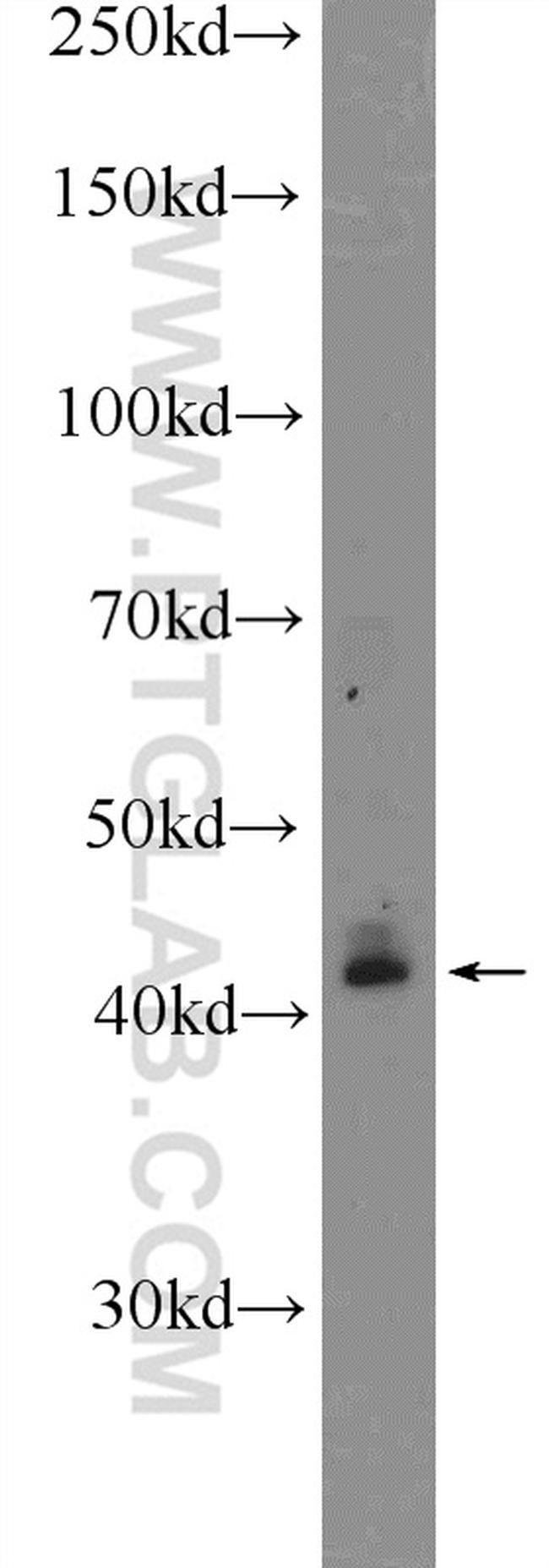 KLF6 Antibody in Western Blot (WB)