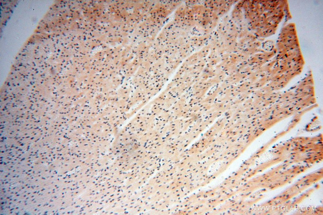 CNBP Antibody in Immunohistochemistry (Paraffin) (IHC (P))