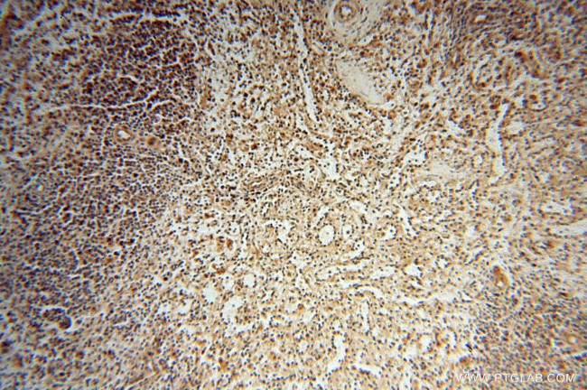 CNBP Antibody in Immunohistochemistry (Paraffin) (IHC (P))