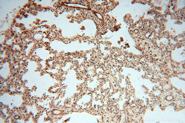 CNBP Antibody in Immunohistochemistry (Paraffin) (IHC (P))