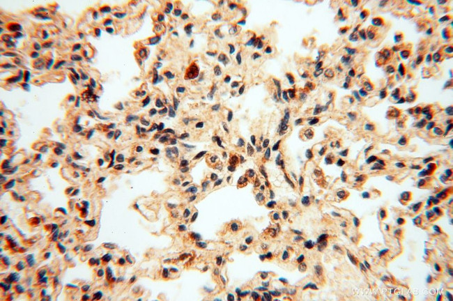 CNBP Antibody in Immunohistochemistry (Paraffin) (IHC (P))