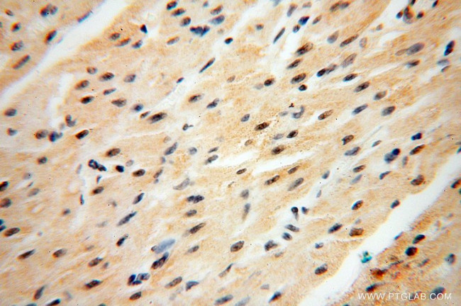 CNBP Antibody in Immunohistochemistry (Paraffin) (IHC (P))