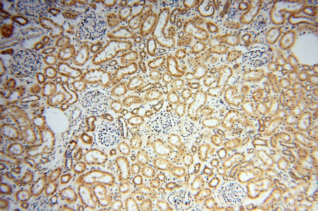 CNBP Antibody in Immunohistochemistry (Paraffin) (IHC (P))