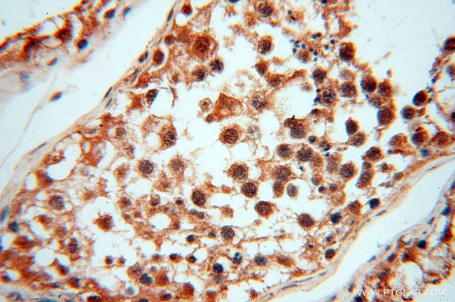 CNBP Antibody in Immunohistochemistry (Paraffin) (IHC (P))