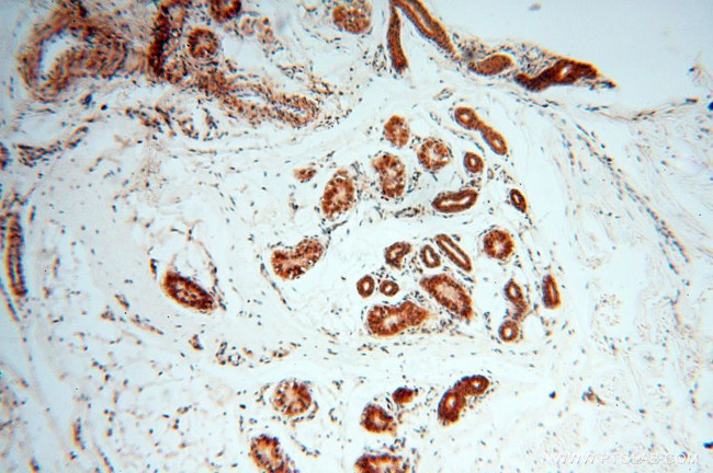 CNBP Antibody in Immunohistochemistry (Paraffin) (IHC (P))