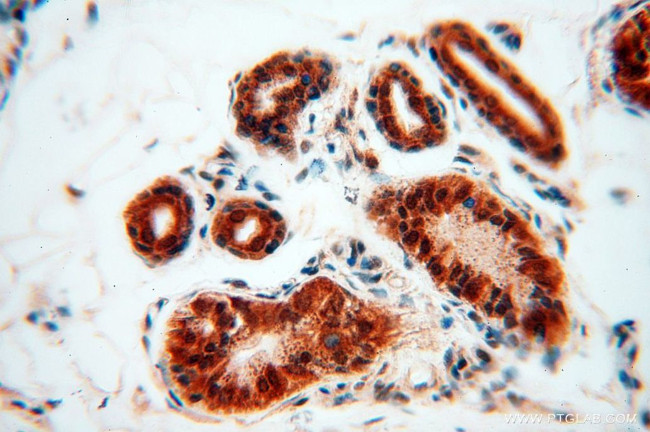 CNBP Antibody in Immunohistochemistry (Paraffin) (IHC (P))