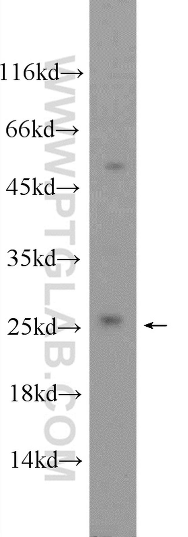 CNBP Antibody in Western Blot (WB)