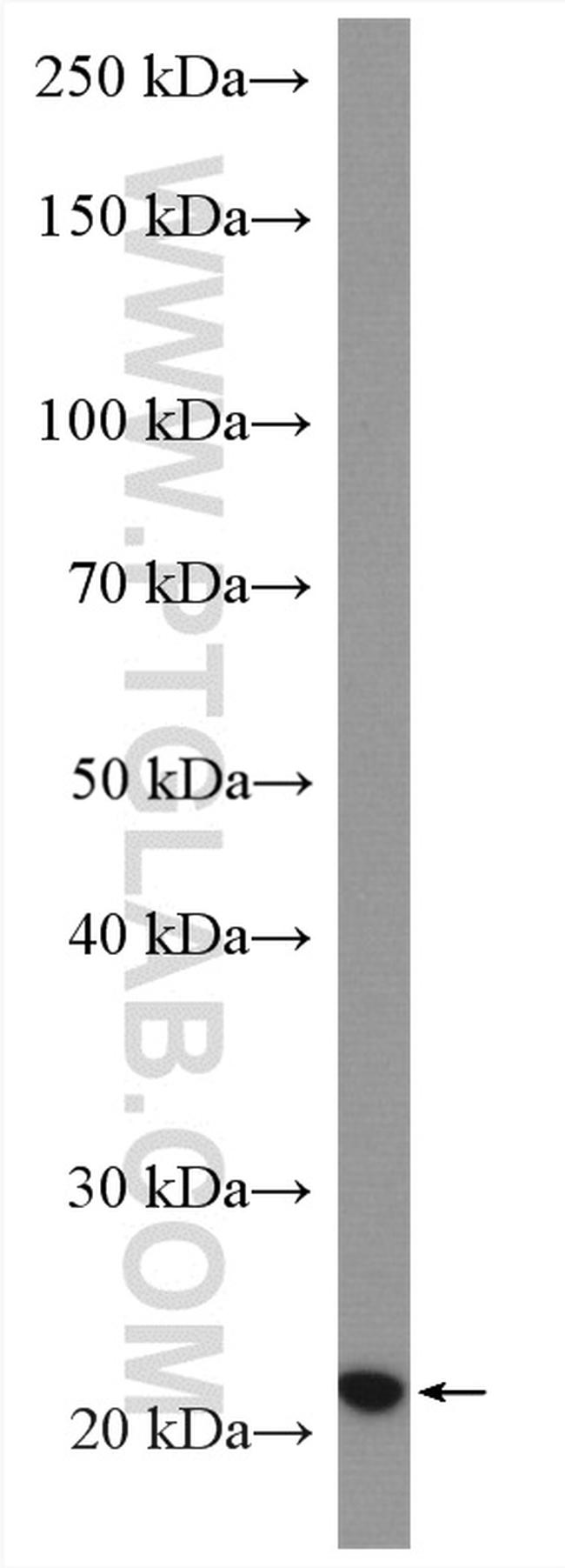 CNBP Antibody in Western Blot (WB)