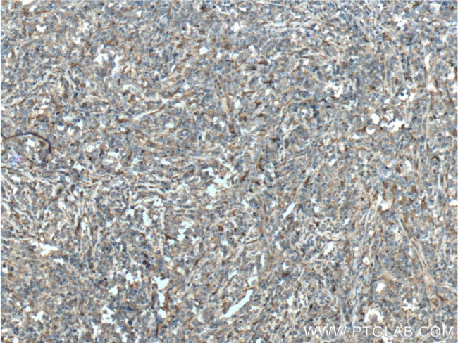 PGD Antibody in Immunohistochemistry (Paraffin) (IHC (P))