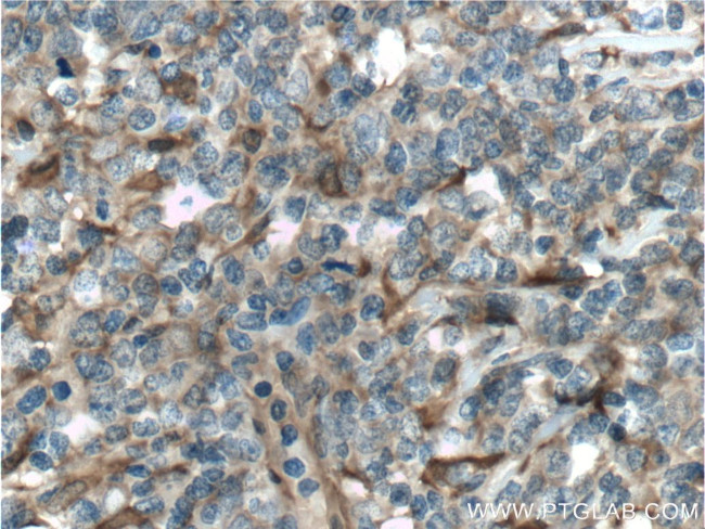 PGD Antibody in Immunohistochemistry (Paraffin) (IHC (P))