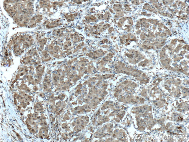 PGD Antibody in Immunohistochemistry (Paraffin) (IHC (P))