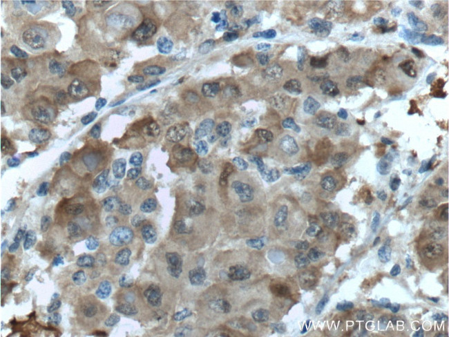 PGD Antibody in Immunohistochemistry (Paraffin) (IHC (P))