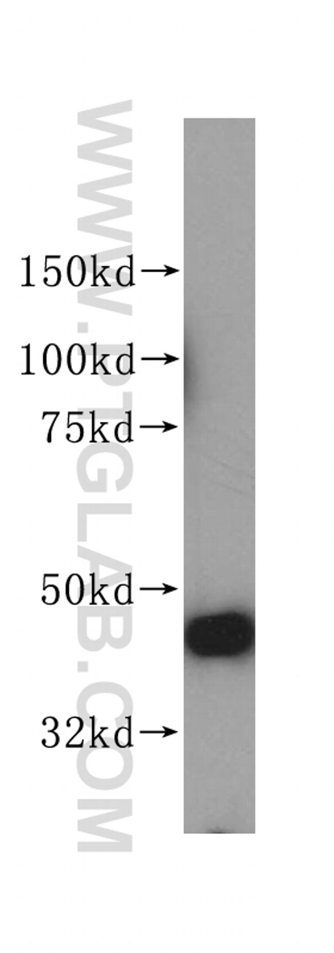 PGD Antibody in Western Blot (WB)