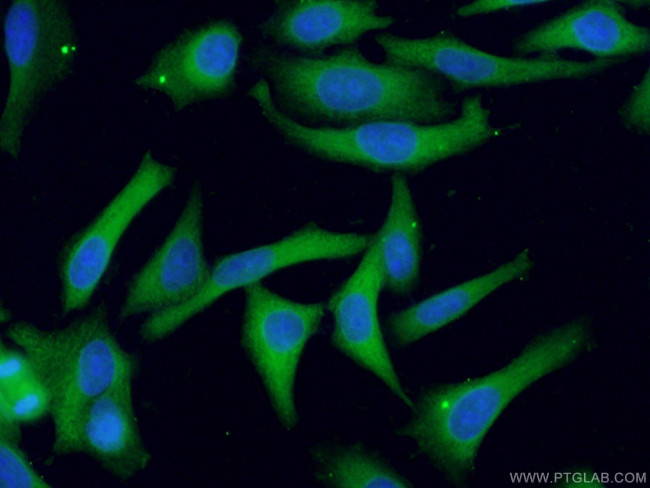 PHGDH Antibody in Immunocytochemistry (ICC/IF)