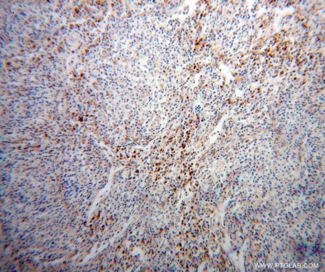 PHGDH Antibody in Immunohistochemistry (Paraffin) (IHC (P))