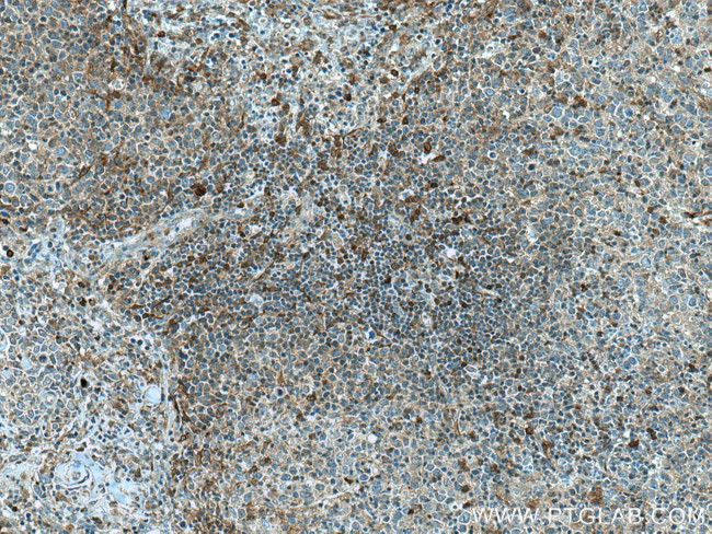 PHGDH Antibody in Immunohistochemistry (Paraffin) (IHC (P))