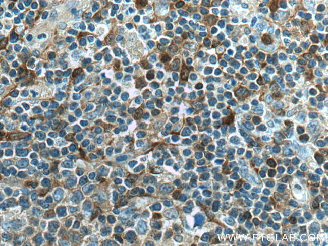 PHGDH Antibody in Immunohistochemistry (Paraffin) (IHC (P))