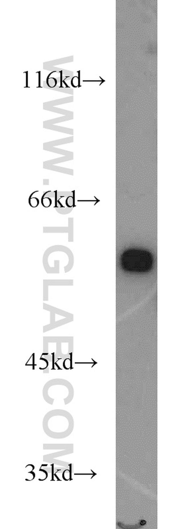 PHGDH Antibody in Western Blot (WB)