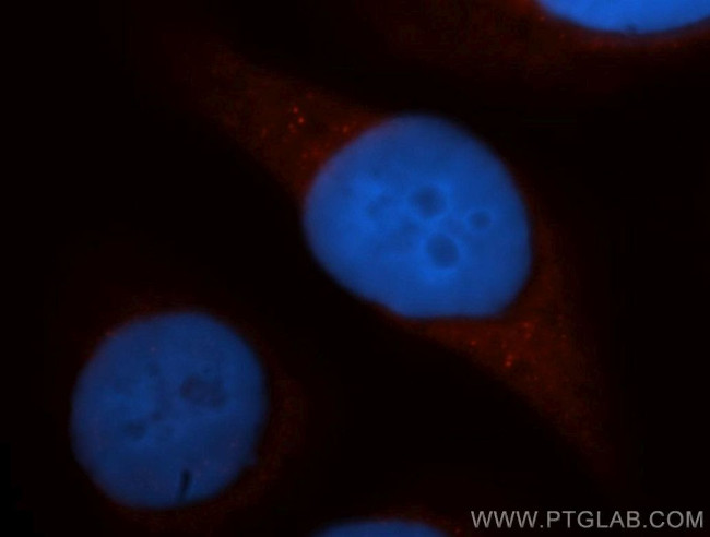 DAPP1 Antibody in Immunocytochemistry (ICC/IF)