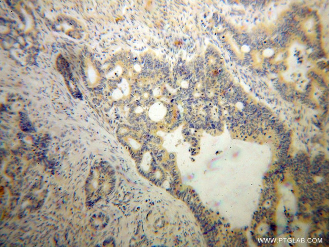 DAPP1 Antibody in Immunohistochemistry (Paraffin) (IHC (P))