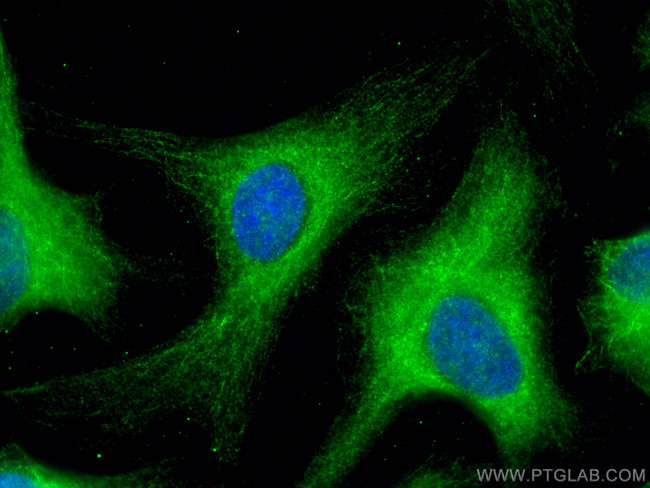 SPAG5 Antibody in Immunocytochemistry (ICC/IF)