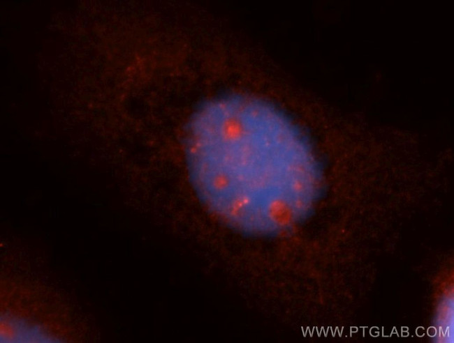 SPAG5 Antibody in Immunocytochemistry (ICC/IF)