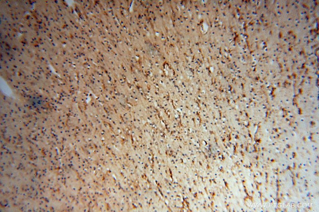 SPAG5 Antibody in Immunohistochemistry (Paraffin) (IHC (P))