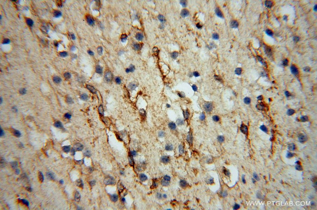 SPAG5 Antibody in Immunohistochemistry (Paraffin) (IHC (P))