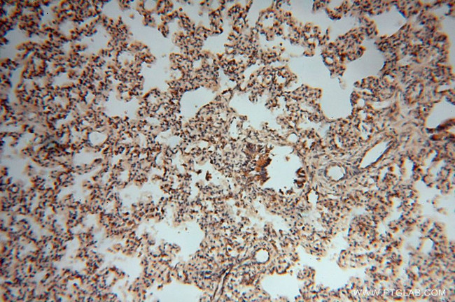 SPAG5 Antibody in Immunohistochemistry (Paraffin) (IHC (P))