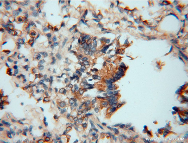 SPAG5 Antibody in Immunohistochemistry (Paraffin) (IHC (P))