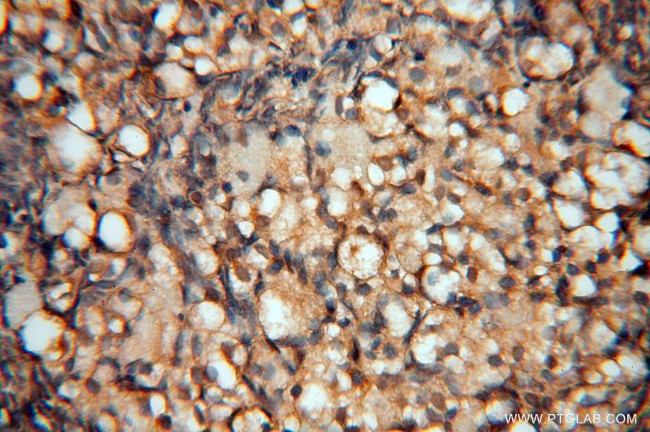 SPAG5 Antibody in Immunohistochemistry (Paraffin) (IHC (P))