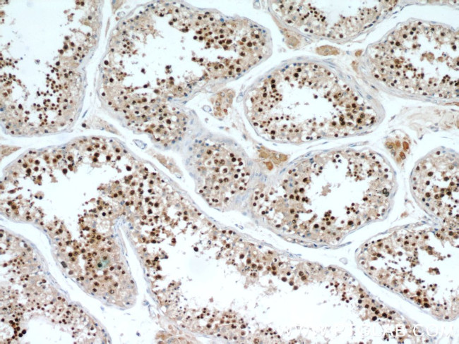 SPAG5 Antibody in Immunohistochemistry (Paraffin) (IHC (P))