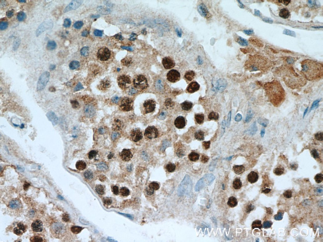 SPAG5 Antibody in Immunohistochemistry (Paraffin) (IHC (P))