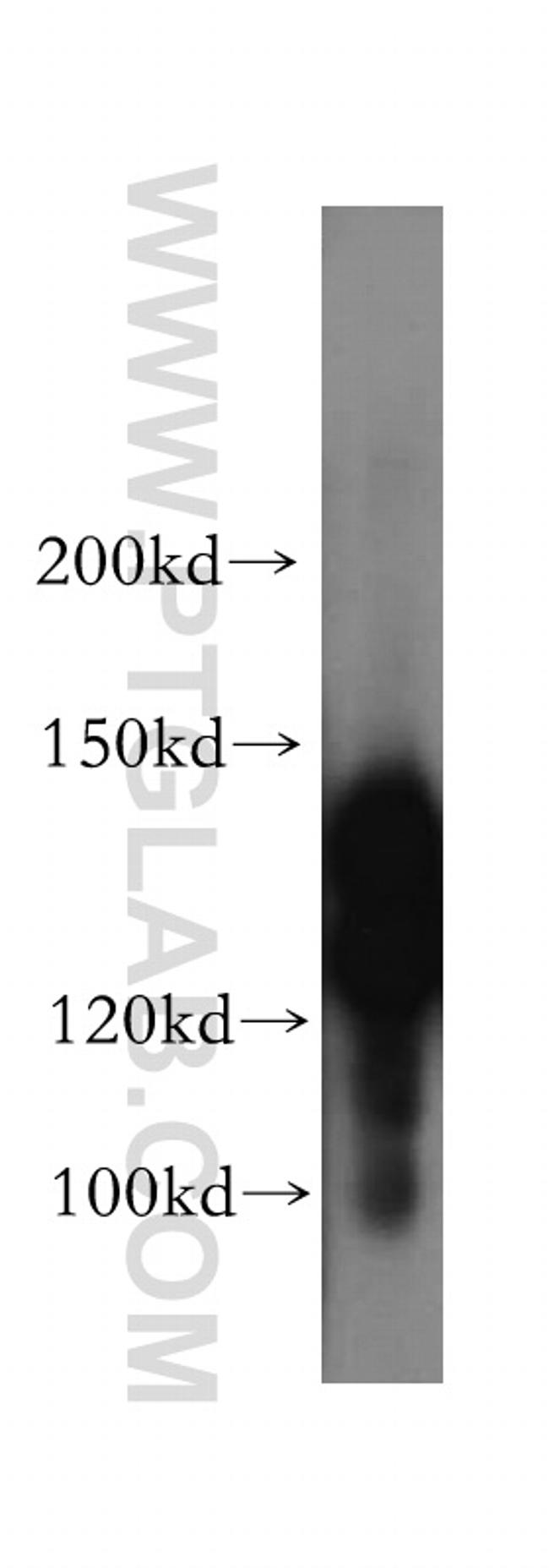 SPAG5 Antibody in Western Blot (WB)