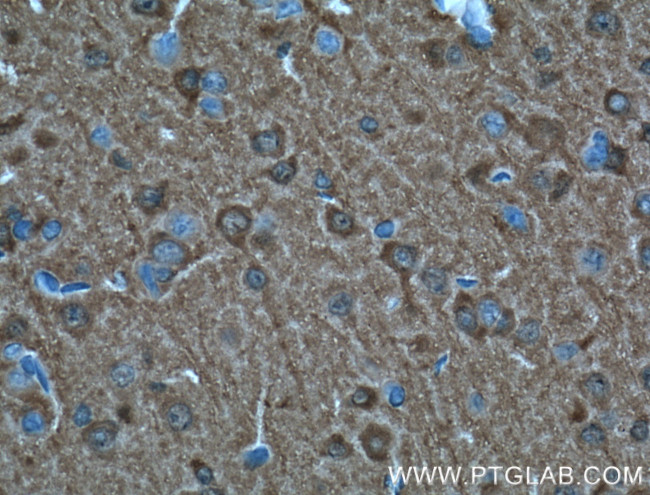 UCHL1/PGP9.5 Antibody in Immunohistochemistry (Paraffin) (IHC (P))